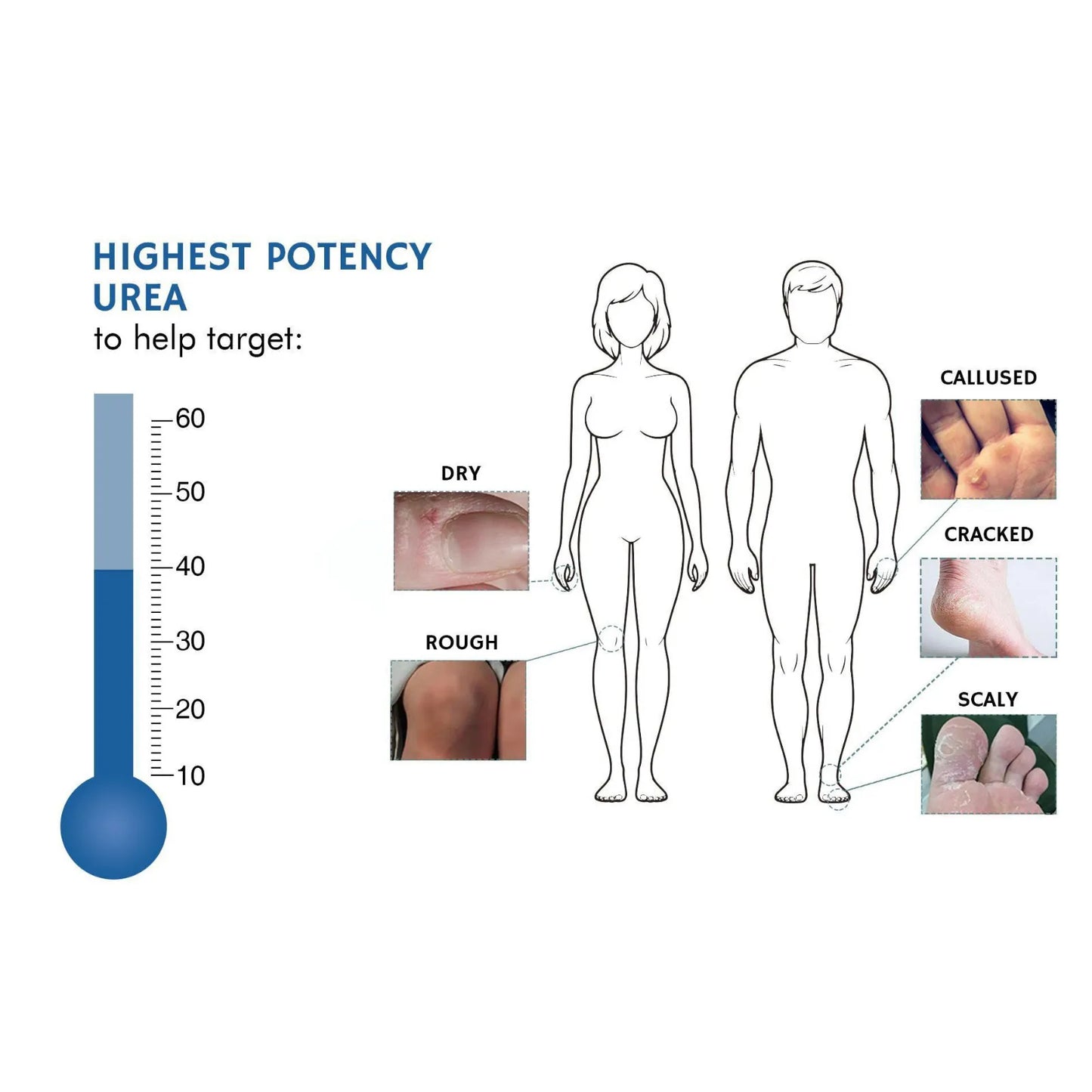 Urea Cream 42% Foot Cream 100g/Bottle