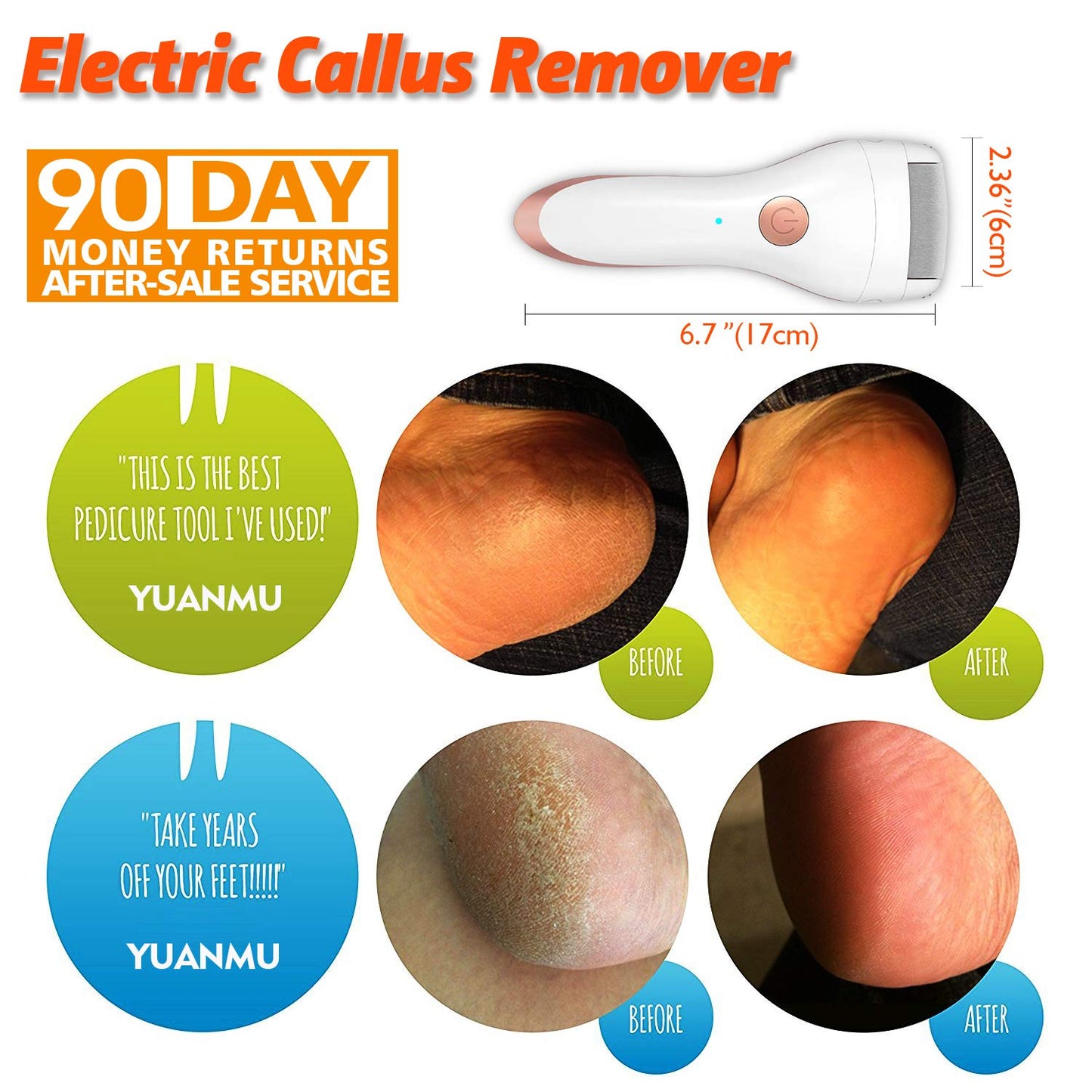 Electric Portable Callus and Foot File