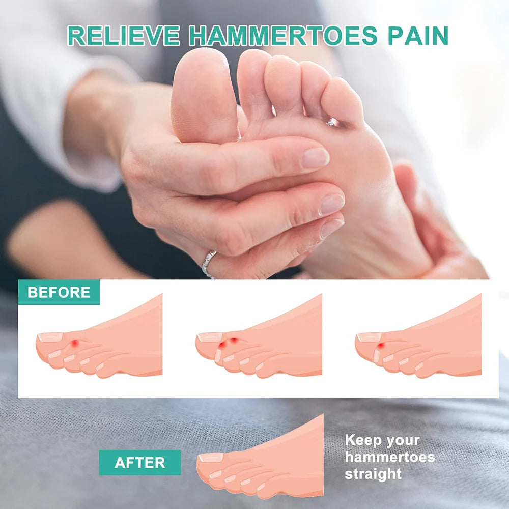 Pexmen 2/4Pcs Hammer Toe Protector