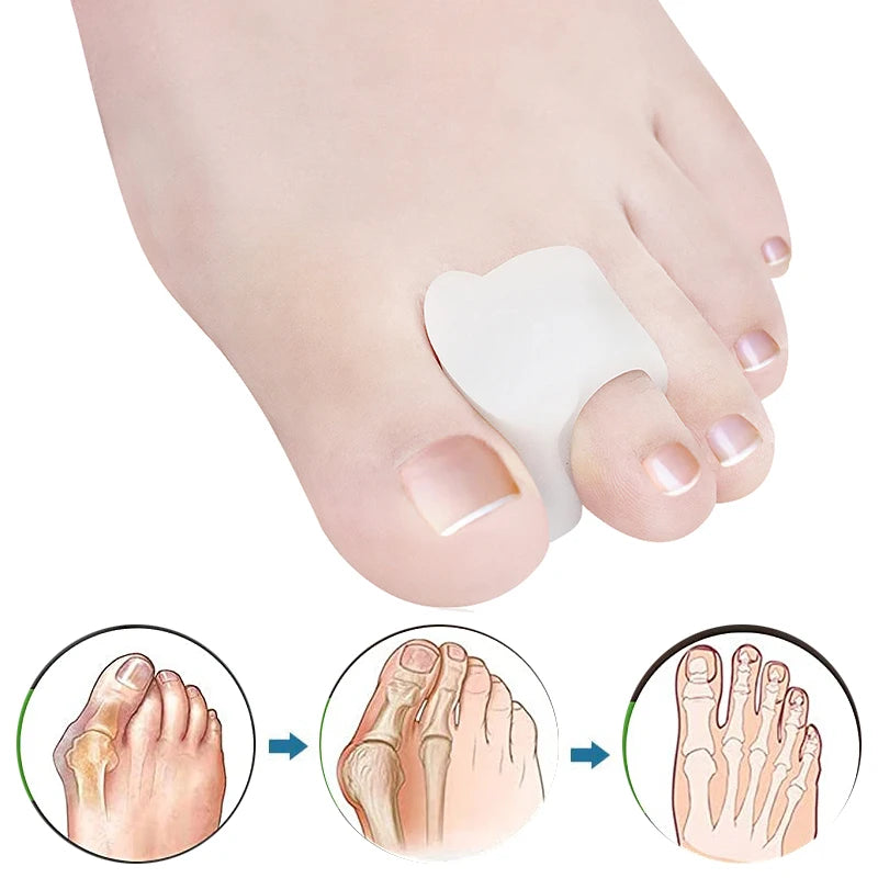 Pexmen Toe Separators