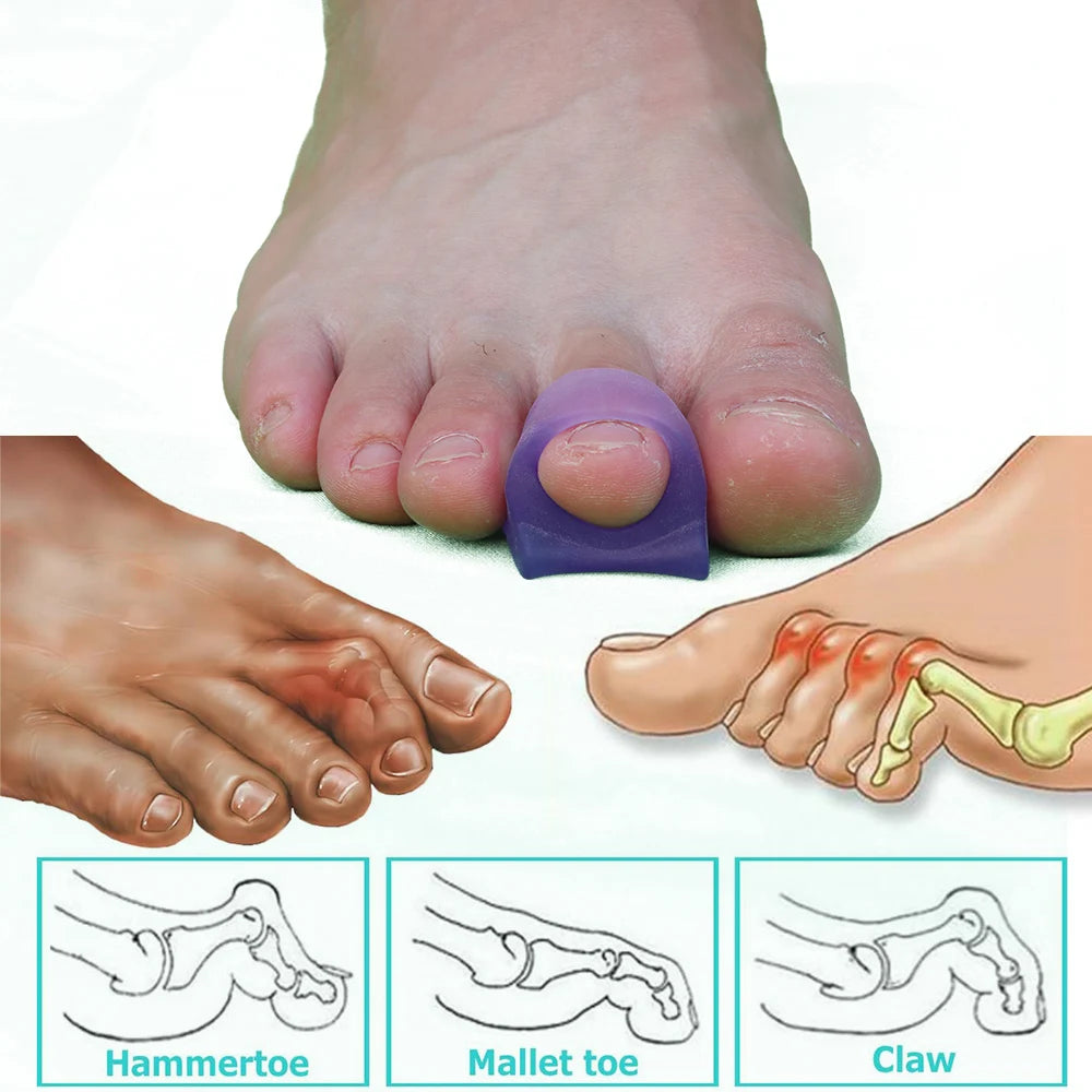 Pexmen 2/4Pcs Hammer Toe Protector