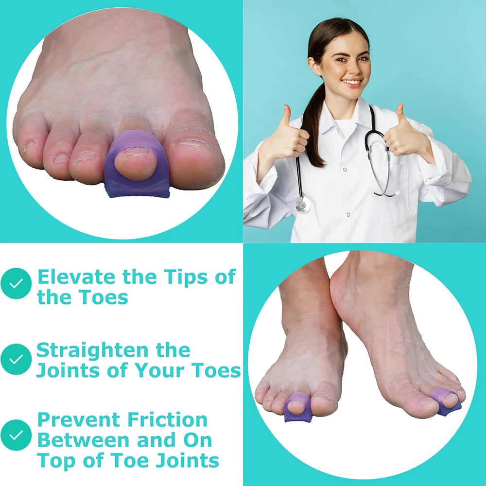 Pexmen 2/4Pcs Hammer Toe Protector