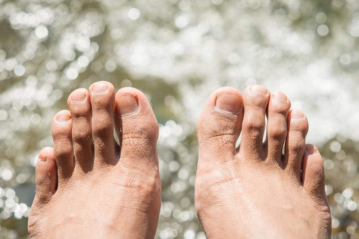 Top 3 Foot Care Tips for Preventing Toenail Fungus