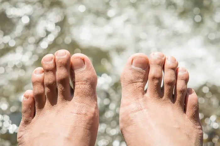 Top 3 Foot Care Tips for Preventing Toenail Fungus