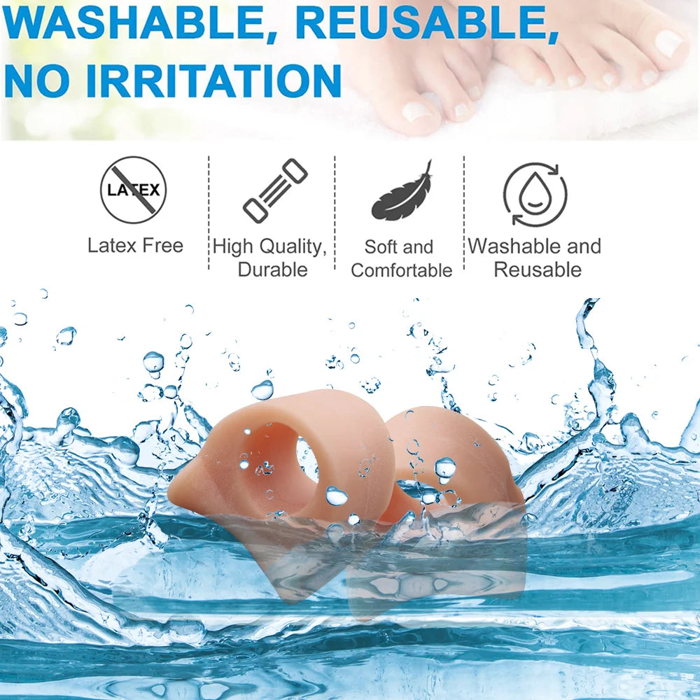 Toe Spacers for Overlapping Hallux Valgus