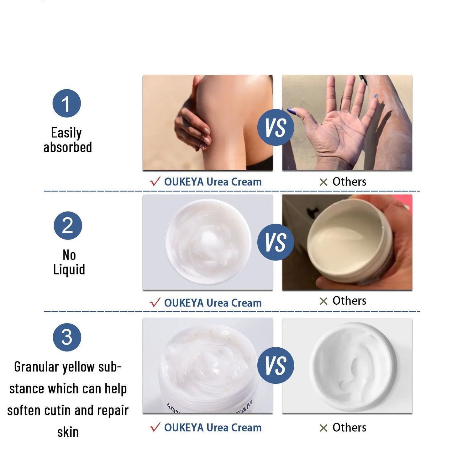 Urea Cream 42% Foot Cream 100g/Bottle
