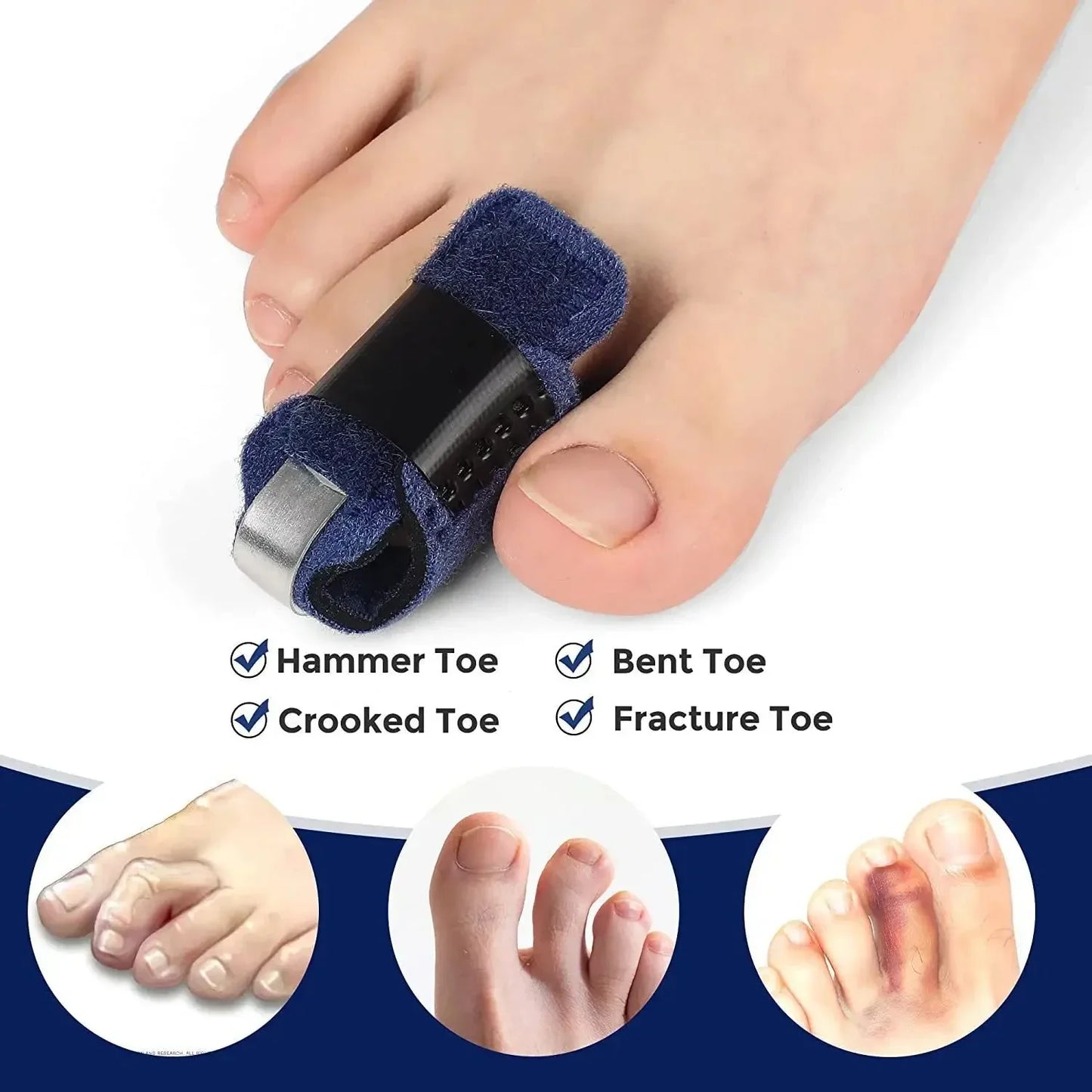 Toe Splint 1/2Pcs