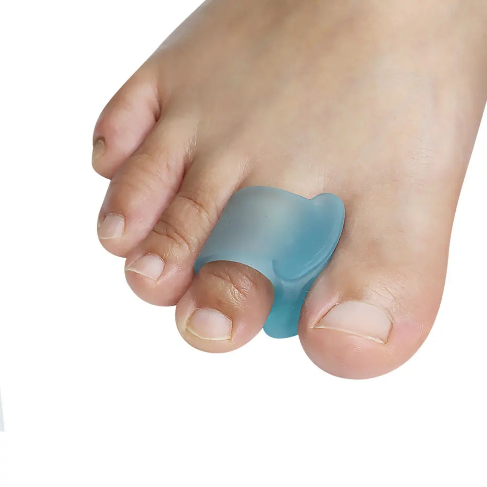 Toe Spacers for Overlapping Hallux Valgus