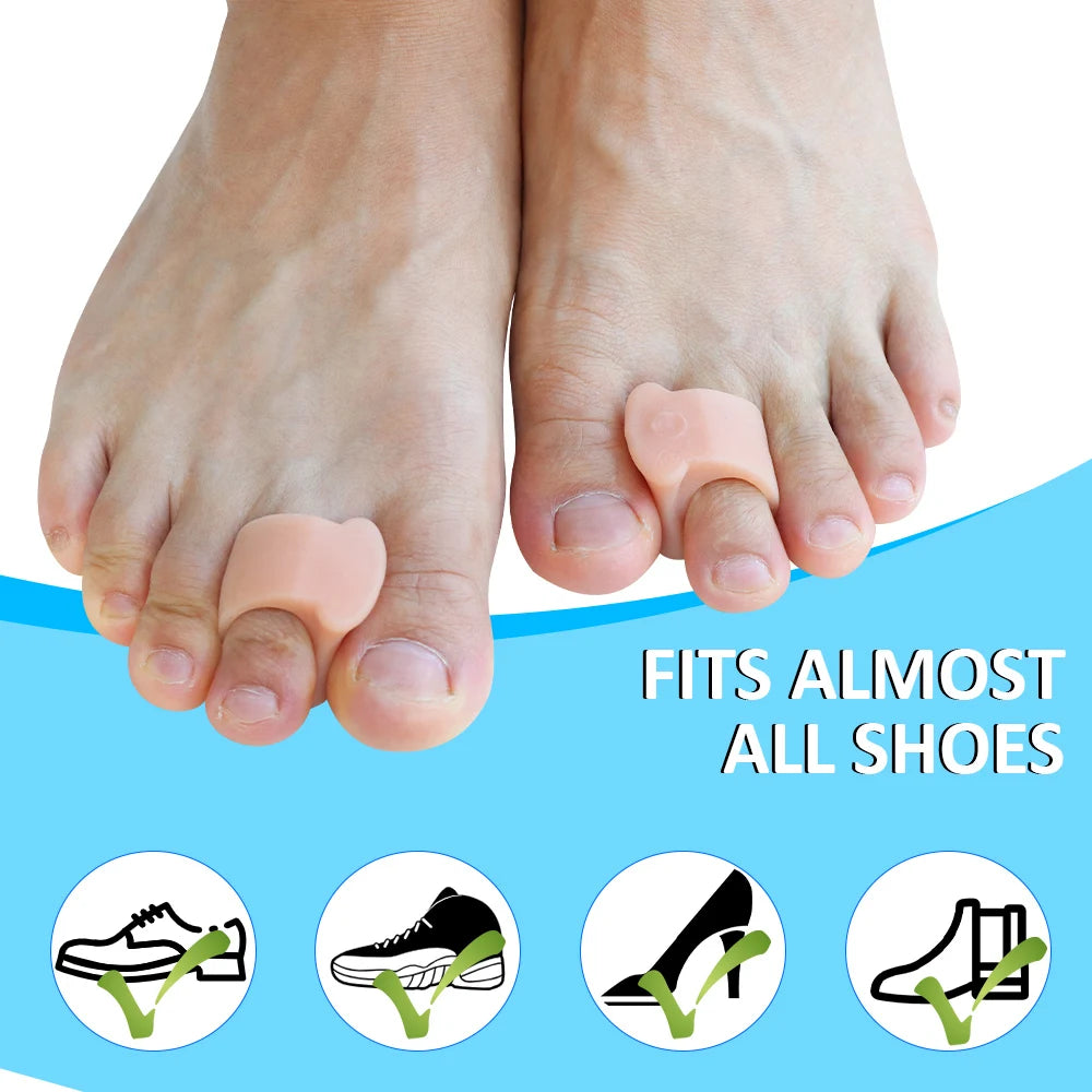 Toe Spacers for Overlapping Hallux Valgus