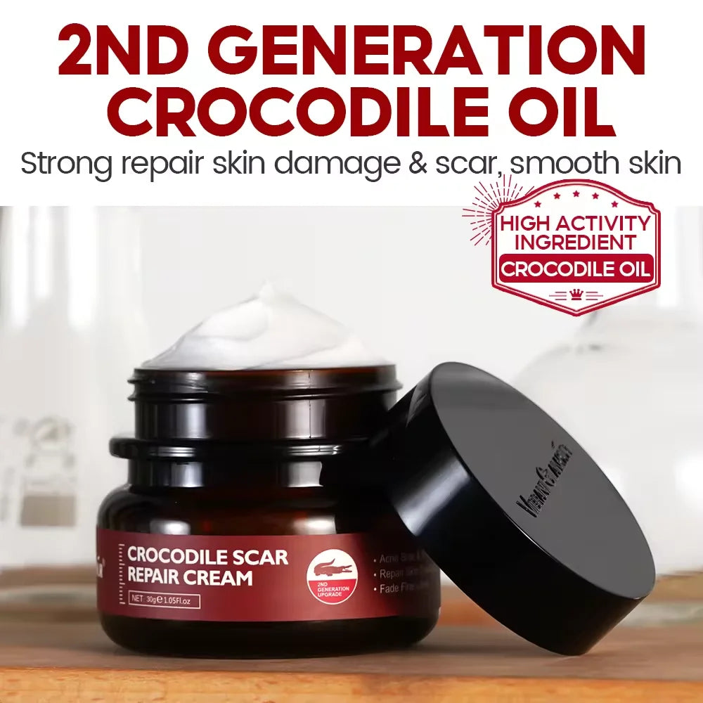 Crocodile Scar Repair Cream