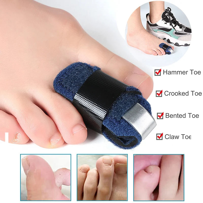 1/2Pcs Toe Splint/Toe Straightener