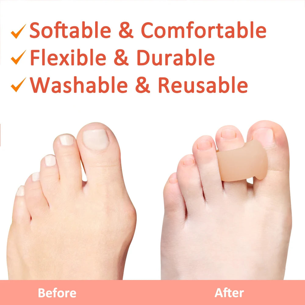 Pexmen Toe Separators