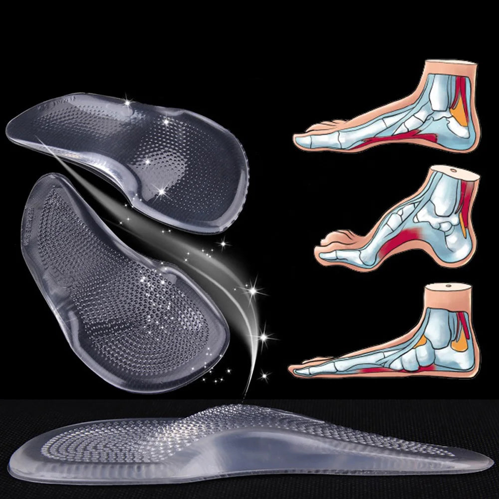 Silicone Gel Orthopedic Insoles for Shoes Women Flat Feet Arch Support Foot Insoles for Plantar Faciitis Pain Relief Shoe Pads
