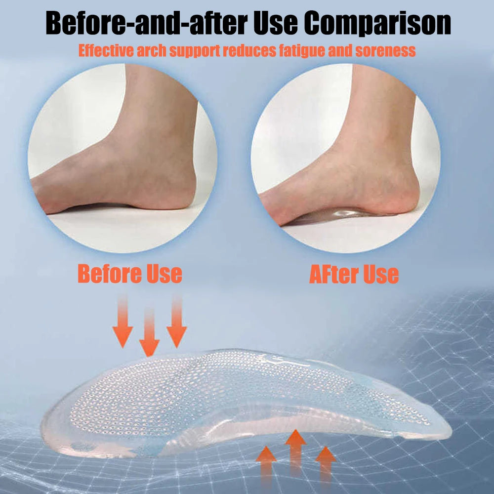 Silicone Gel Orthopedic Insoles for Shoes Women Flat Feet Arch Support Foot Insoles for Plantar Faciitis Pain Relief Shoe Pads