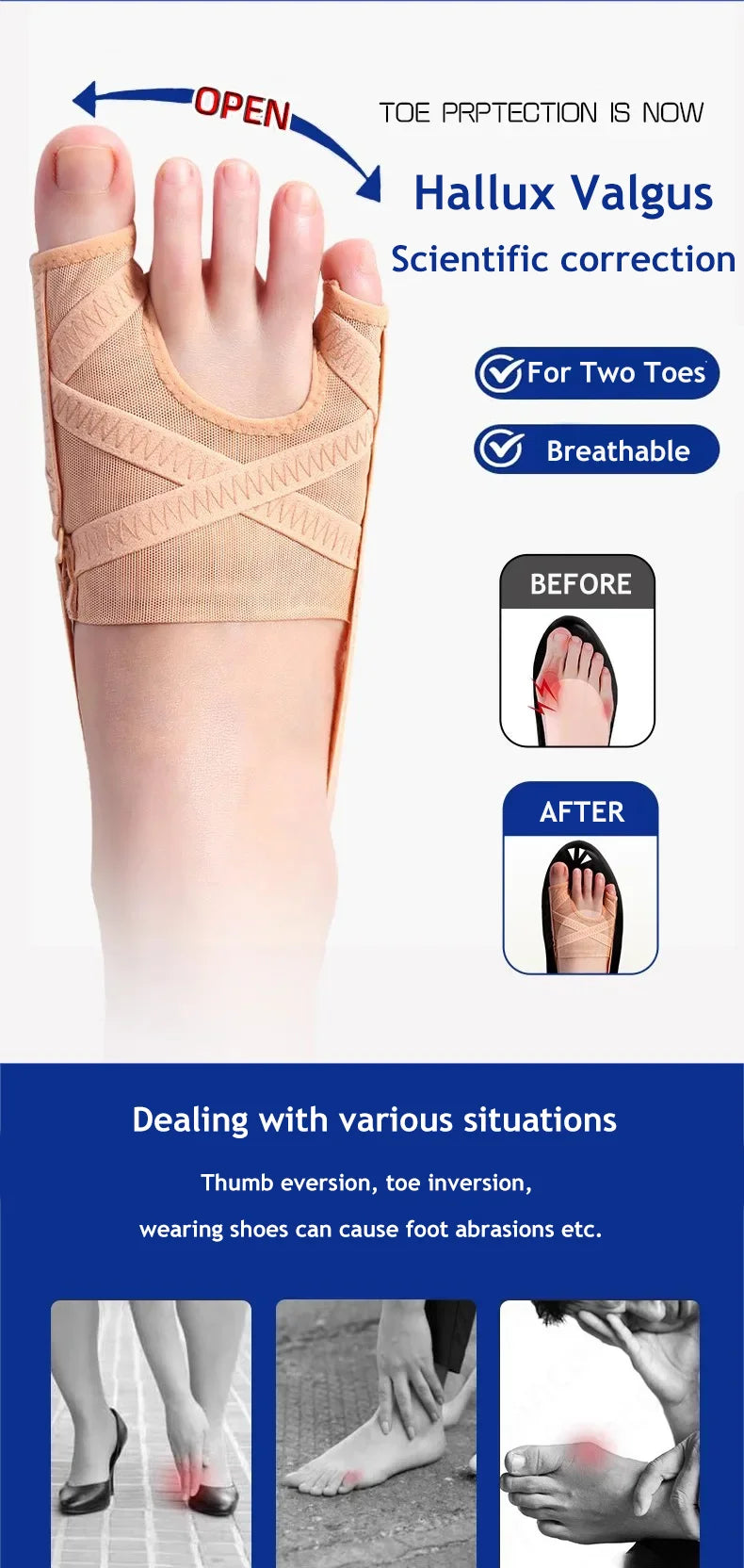 Fabric Bunion Corrector Breathable Adjustable Hallux Valgus Sleeve Spacer Separator Toe Corrector Sports Bunion Socks Running