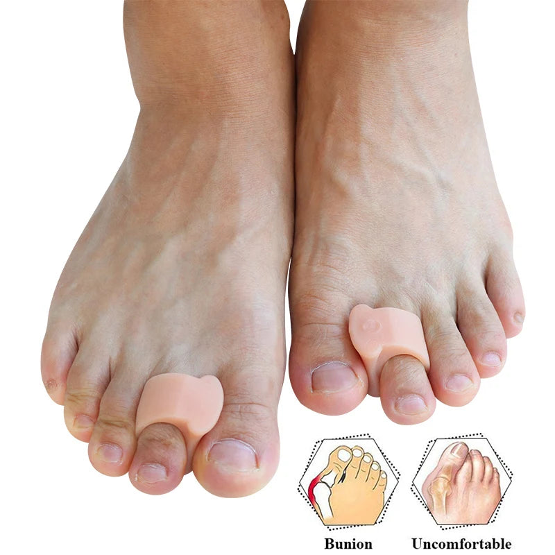 Toe Spacers for Overlapping Hallux Valgus