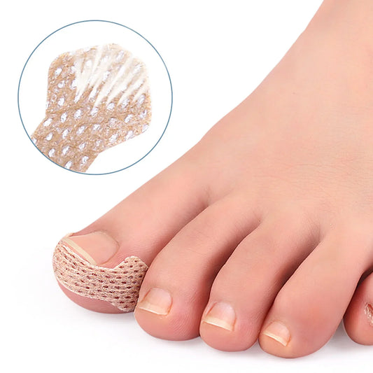 Ingrown Toenail Corrector Strips