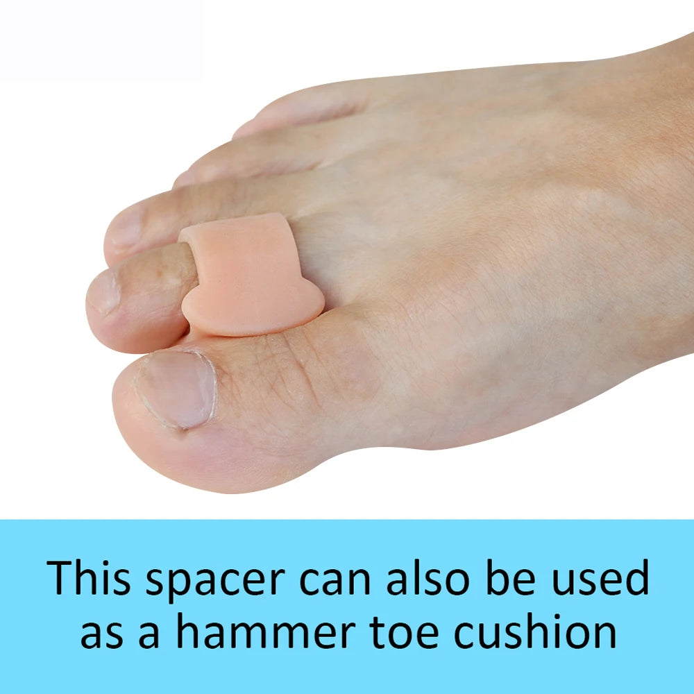 Toe Spacers for Overlapping Hallux Valgus
