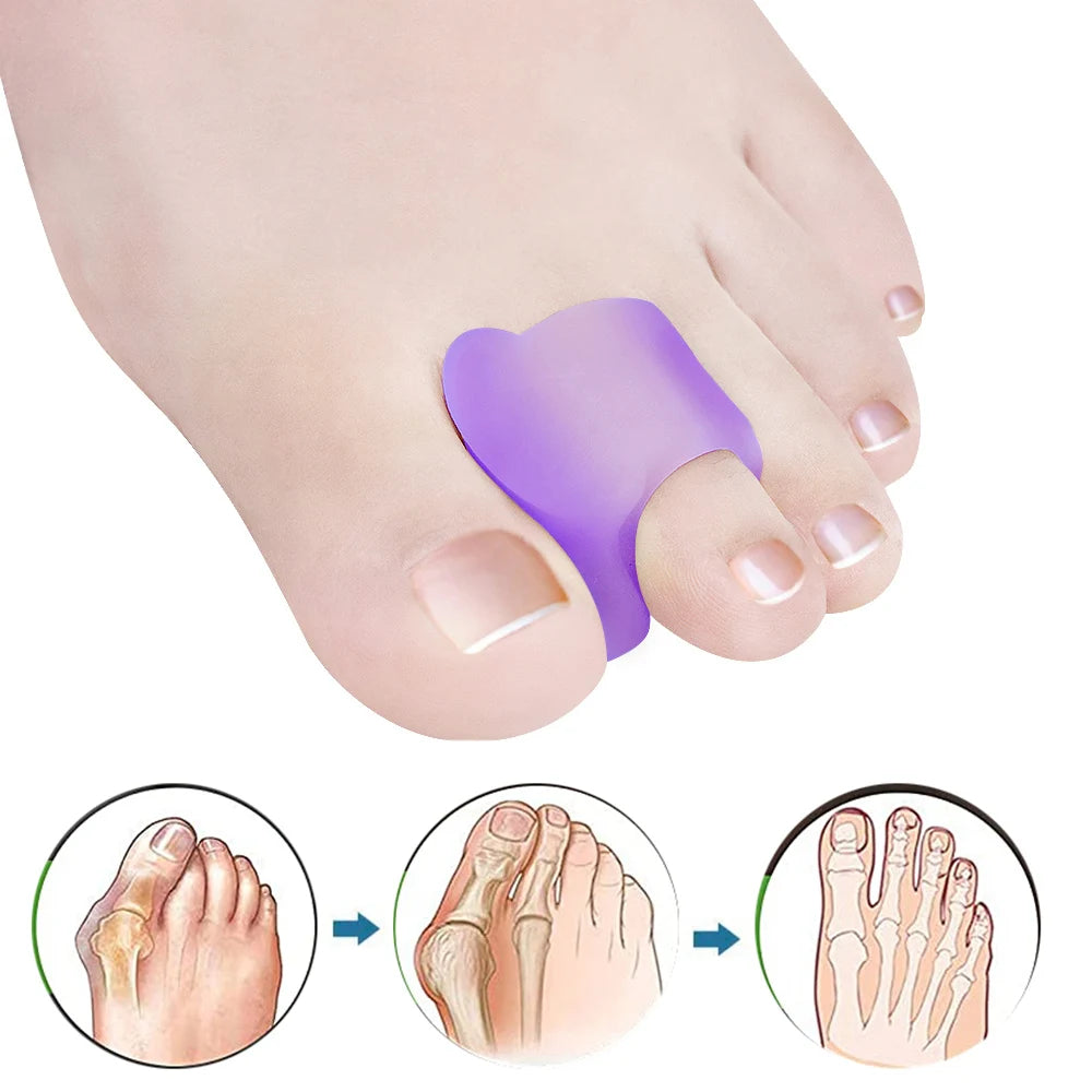 Pexmen Toe Separators