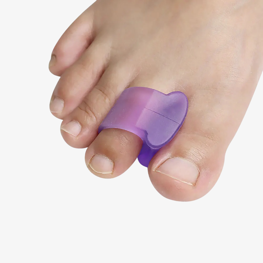Toe Spacers for Overlapping Hallux Valgus