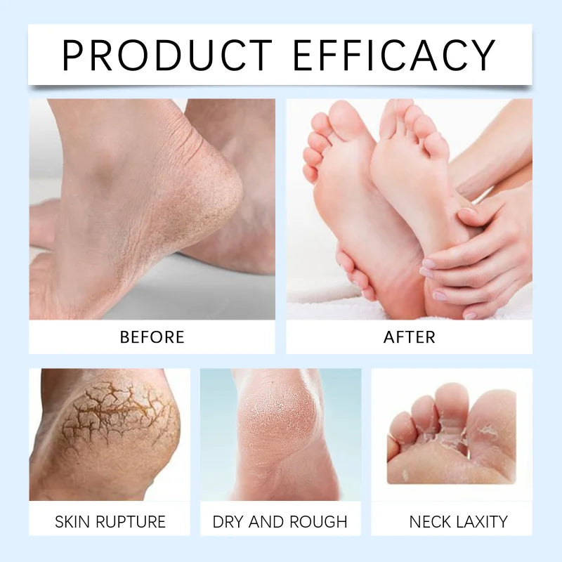 Podiatrist Recommended Foot Moisturizing Cream