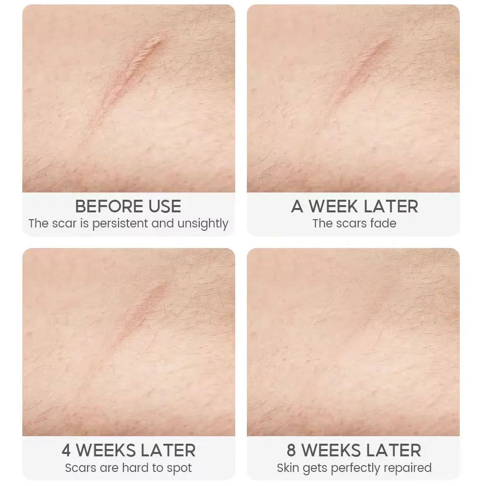 Crocodile Scar Repair Cream