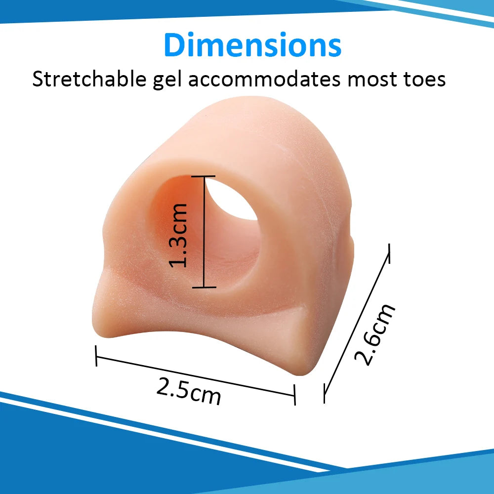 Toe Spacers for Overlapping Hallux Valgus