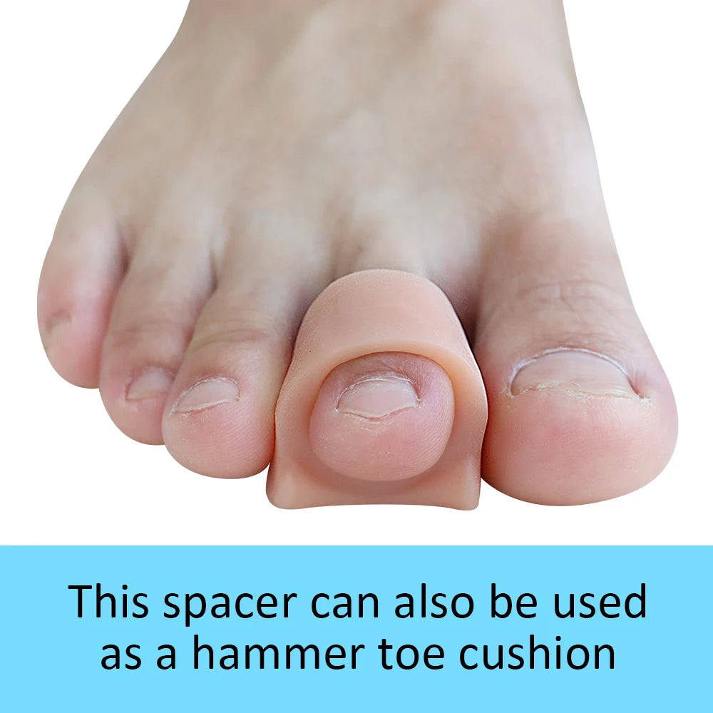 Toe Spacers for Overlapping Hallux Valgus